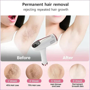 Premium IPL Hair Laser Remover