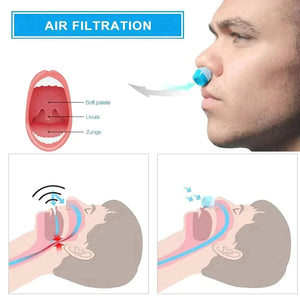 Micro CPAP Device